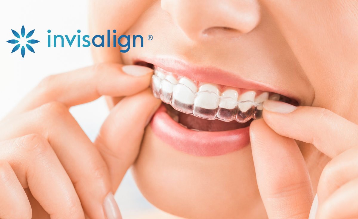 Invisible Orthodontics Invisalign